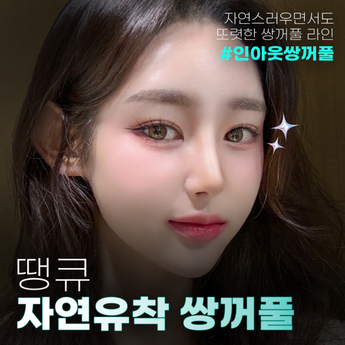 인아웃라인쌍커풀 자연유착매몰 방식으로 예쁘게! 관련 이미지 1