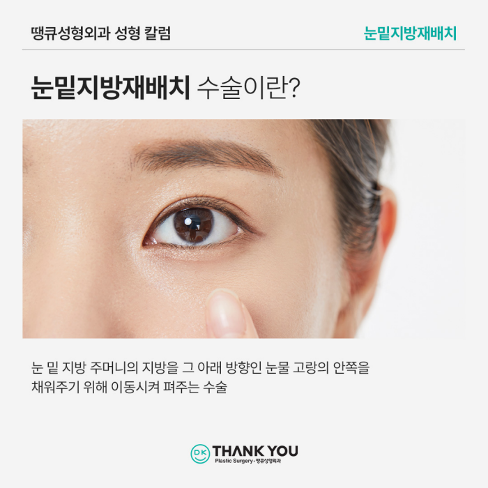 눈밑지방재배치병원에서 알려주는 수술이 필요한 케이스 관련 이미지 2
