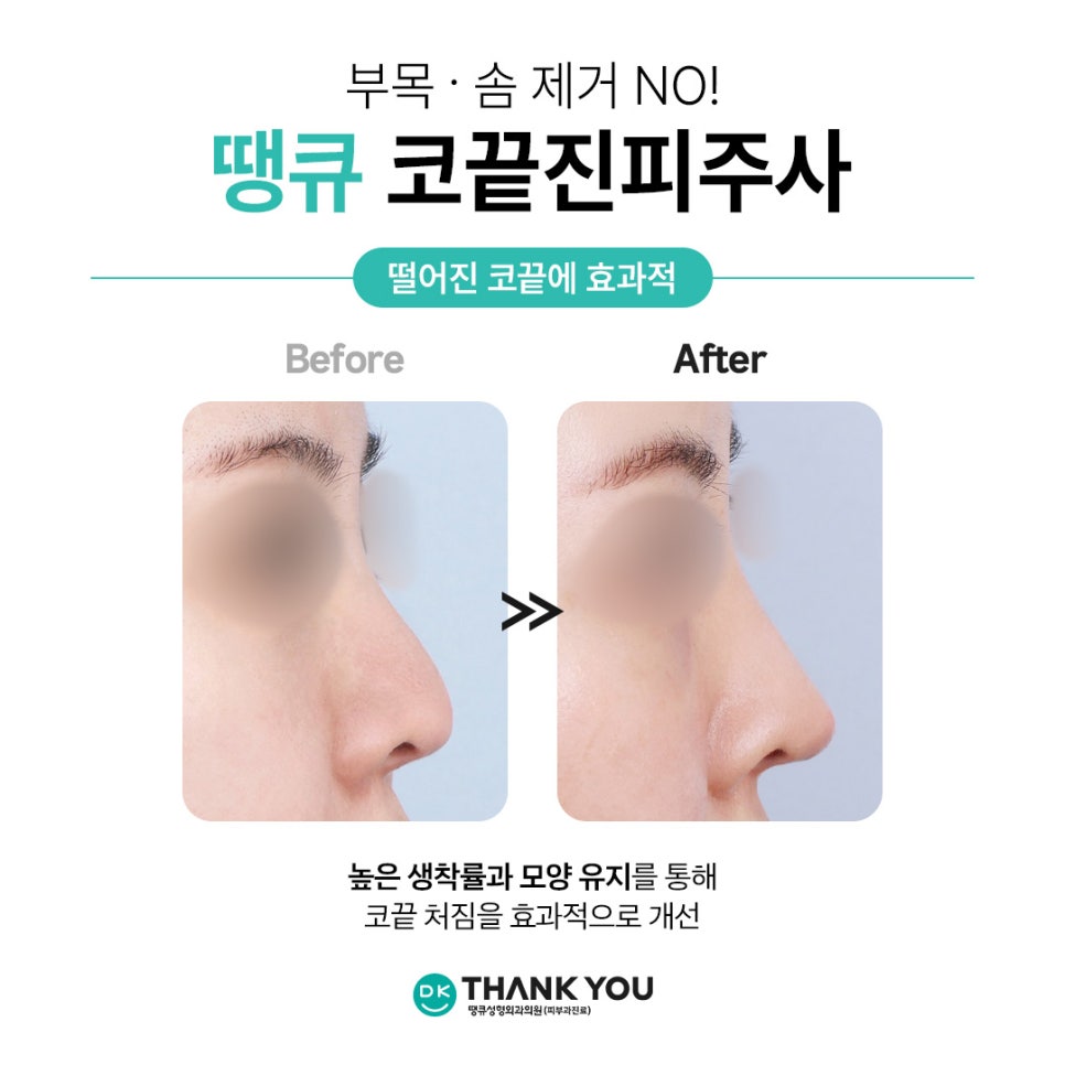 코끝진피주사 잘하는곳 땡큐 EVENT! 오똑한 코끝 만들기✨ 관련 이미지 9