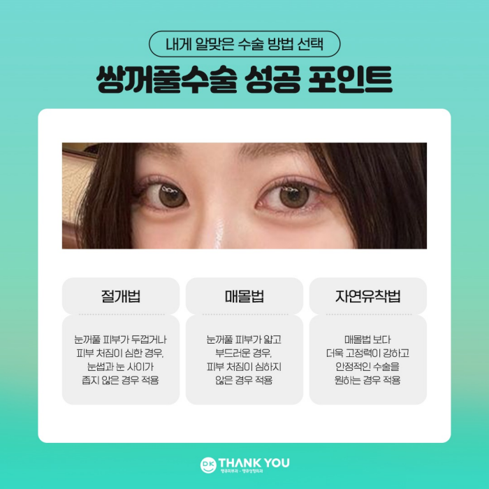 쌍꺼풀수술병원에서 알려주는 눈성형 성공 포인트! 관련 이미지 3