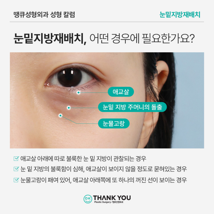 눈밑지방재배치병원에서 알려주는 수술이 필요한 케이스 관련 이미지 3