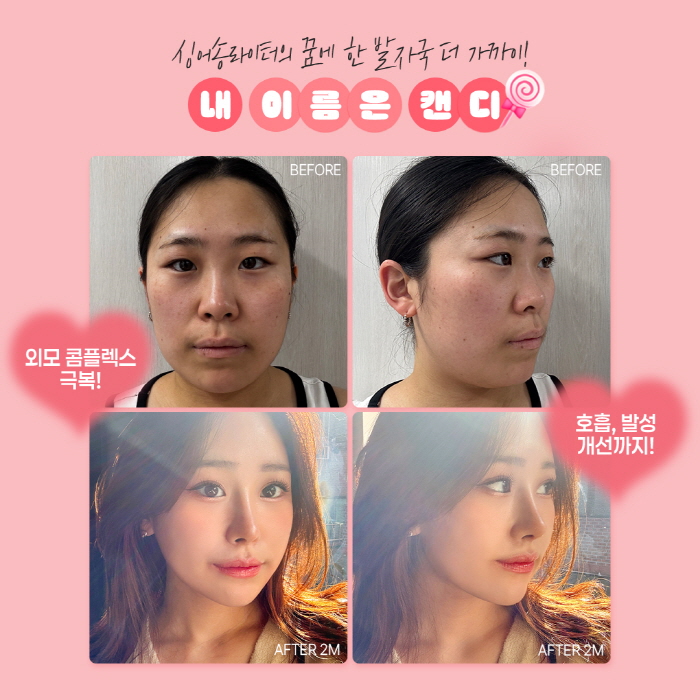 맥미걸 관련 이미지 12