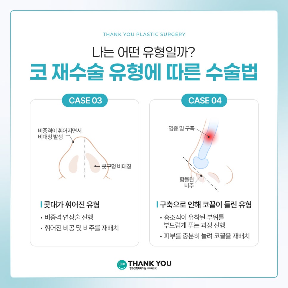 What Does a Contracted Nose Mean, and How Is Revision Surgery Performed? ❓Why Stem Cell Treatment Is Gaining Attention image 10