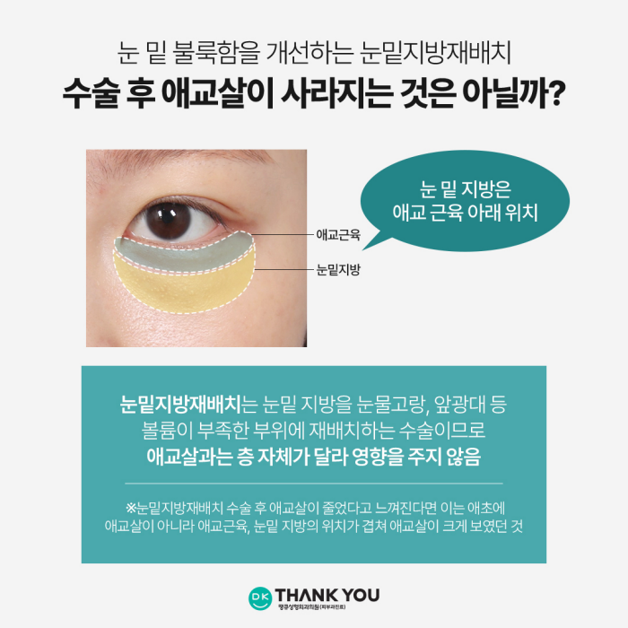 눈밑지전후 애교살에 변화가 생길까? [김다솜 원장 칼럼] 관련 이미지 4