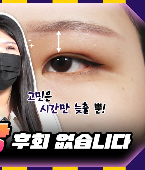 이 나이에?! 20대 이마거상술 (쌍수 후 속쌍 방지🚫) 관련 이미지 2