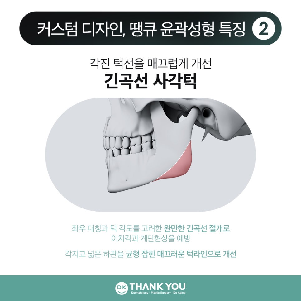 땡큐 윤곽성형 이벤트로 굴곡 없이 작고 매끈한 얼굴 만들기! 관련 이미지 6