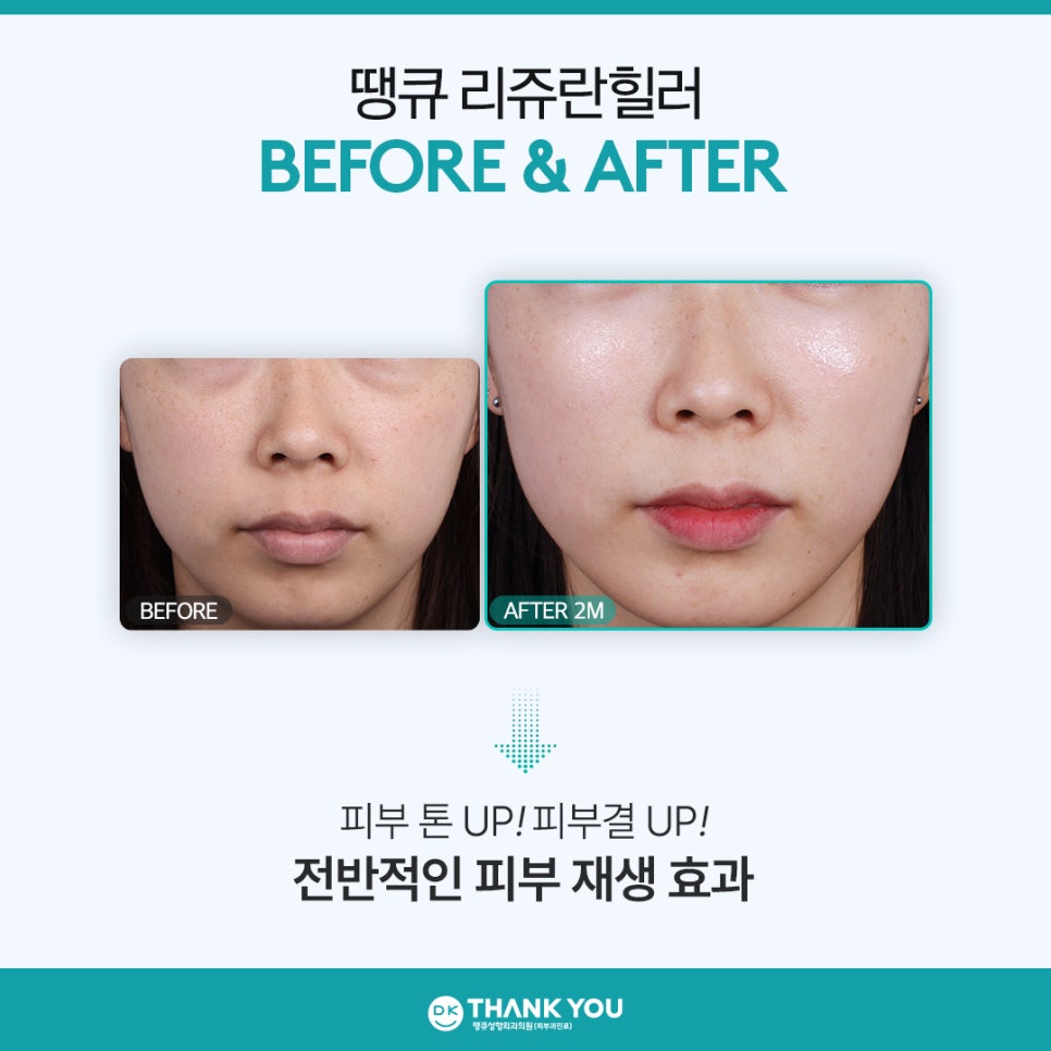 리쥬란힐러잘하는곳 땡큐에서 새해맞이 피부 고민 해결! 관련 이미지 8