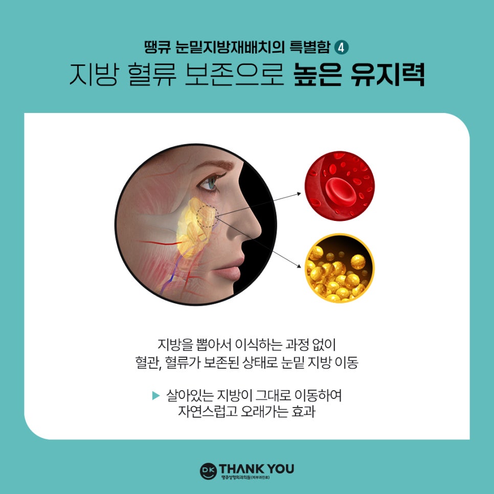 눈밑지방재배치잘하는병원 땡큐만의 특별한 노하우! 관련 이미지 6
