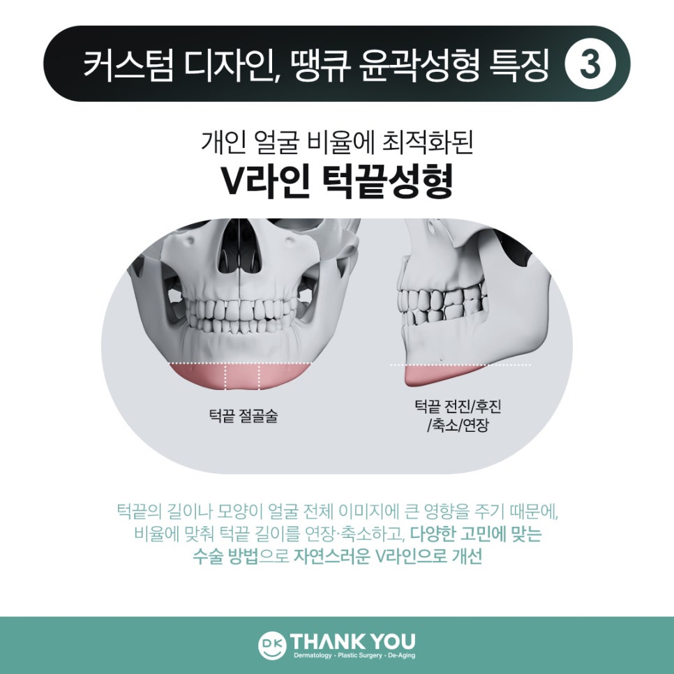 땡큐 윤곽성형 이벤트로 굴곡 없이 작고 매끈한 얼굴 만들기! 관련 이미지 7