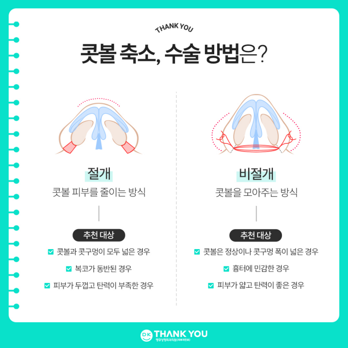 콧볼축소술 후기 좋은 땡큐에서 세련된 코 완성😉 관련 이미지 4