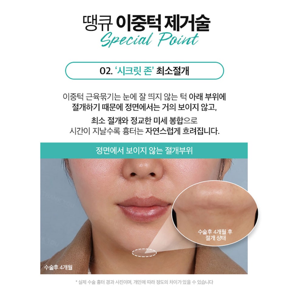 Not Enough Improvement from Chin Liposuction Alone? How About Thank You Double Chin Removal Surgery?! image 11