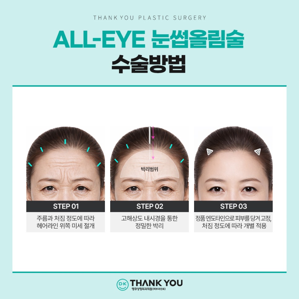 이마거상 흉터, 탈모 걱정된다면? 내시경이마거상술 총정리 관련 이미지 11