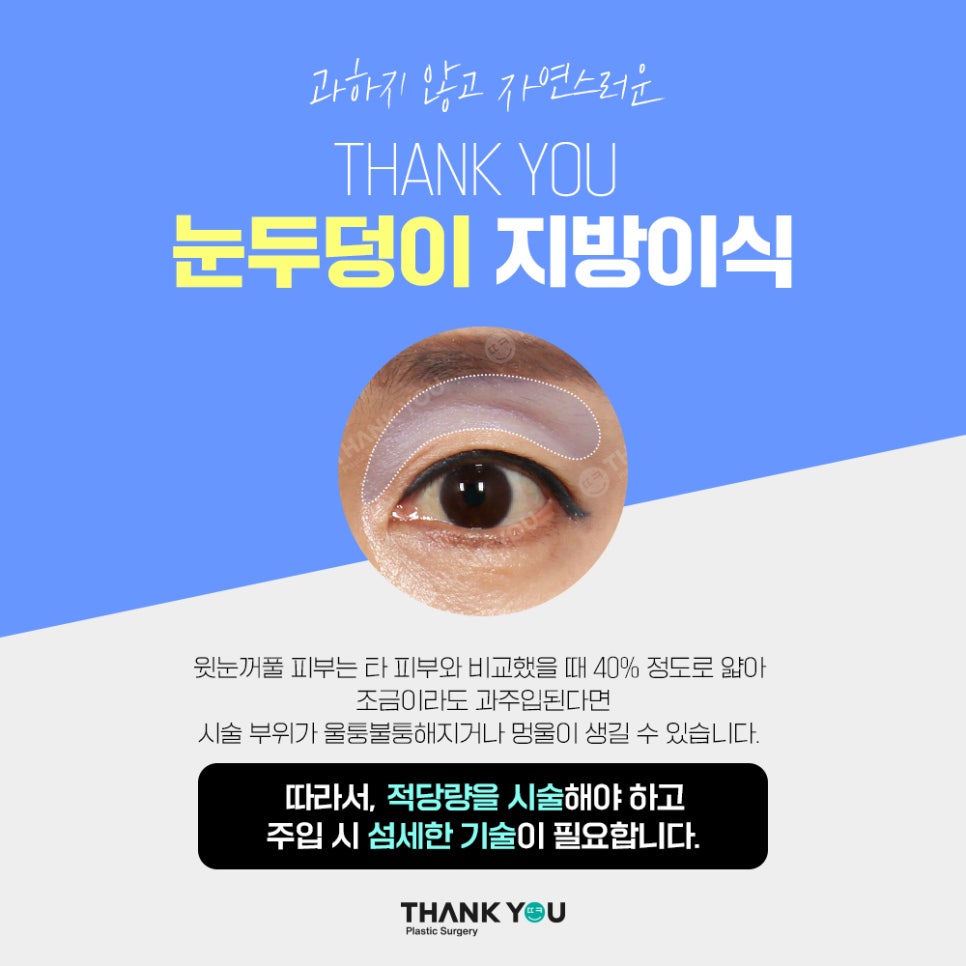 눈두덩이 지방이식, 푹꺼진 눈꺼풀에 자가지방이식으로 관련 이미지 14