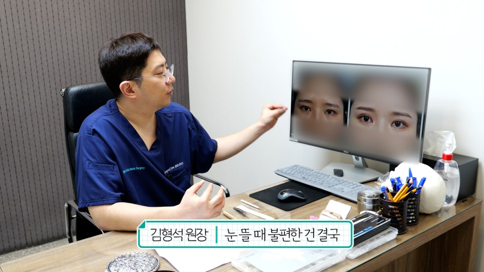 눈재수술 할 때 이마거상 추천하는 이유는? (눈썹올림술 전후) 관련 이미지 11