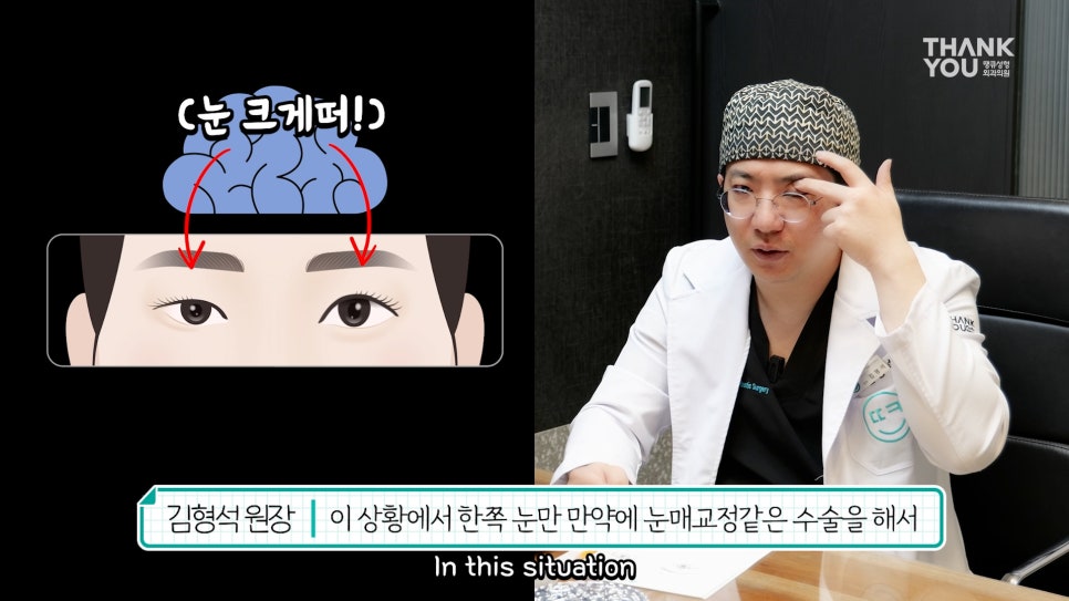비대칭눈 교정(짝짝이 쌍꺼풀) 헤링의 법칙이란? 관련 이미지 10