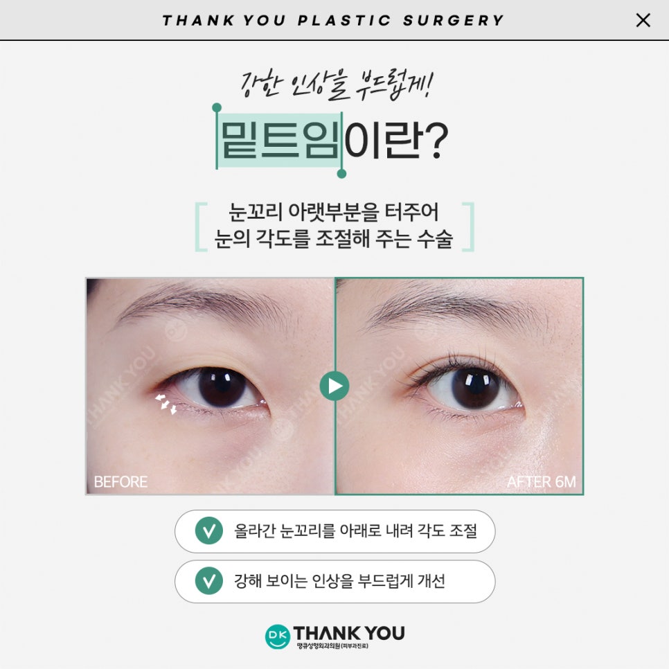 듀얼트임효과로 답답한 꼬막눈을 시원하게! 관련 이미지 4