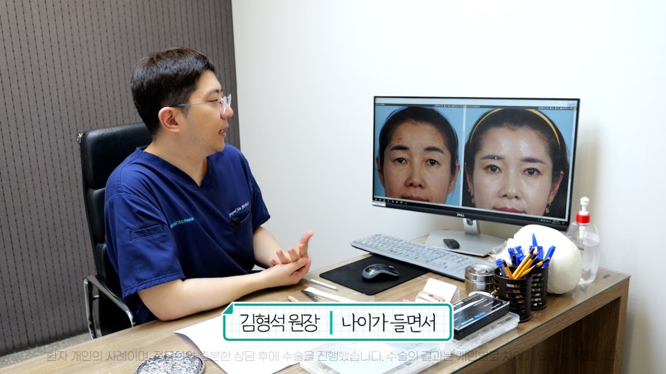 중년눈성형 전후& 이마거상+눈썹하거상+쌍수로 젊어지기 관련 이미지 5