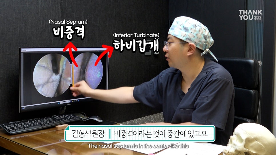 2분만에 막힌 코 뻥 뚫어주는 코블레이션 [ft.비염코성형 전후] 관련 이미지 26