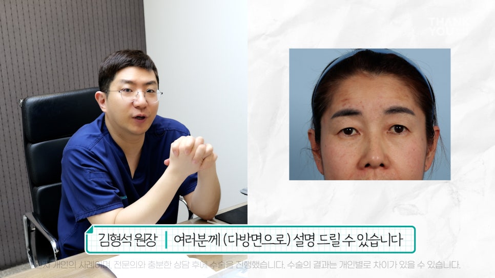 중년눈성형 전후& 이마거상+눈썹하거상+쌍수로 젊어지기 관련 이미지 4