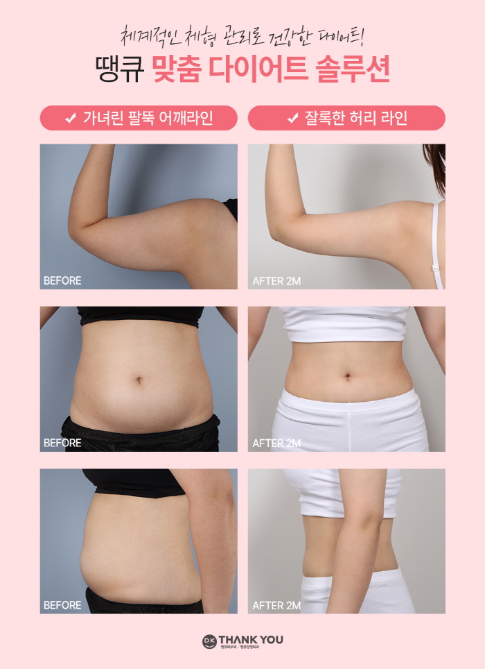 맥미걸 관련 이미지 9
