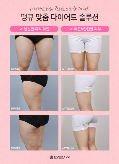 전신지흡 & 체형검사를 통한 성공적인 다이어트! 땡큐 with 맥미걸 관련 이미지 11