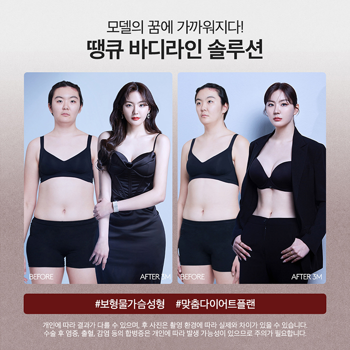 맥미걸 관련 이미지 7