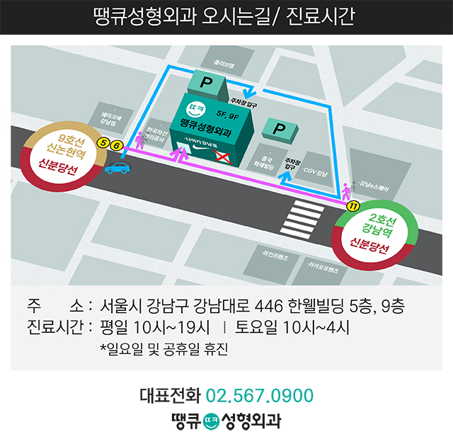 땡큐성형외과, 쌍수 눈매교정? 안검하수 유무 관련 이미지 8