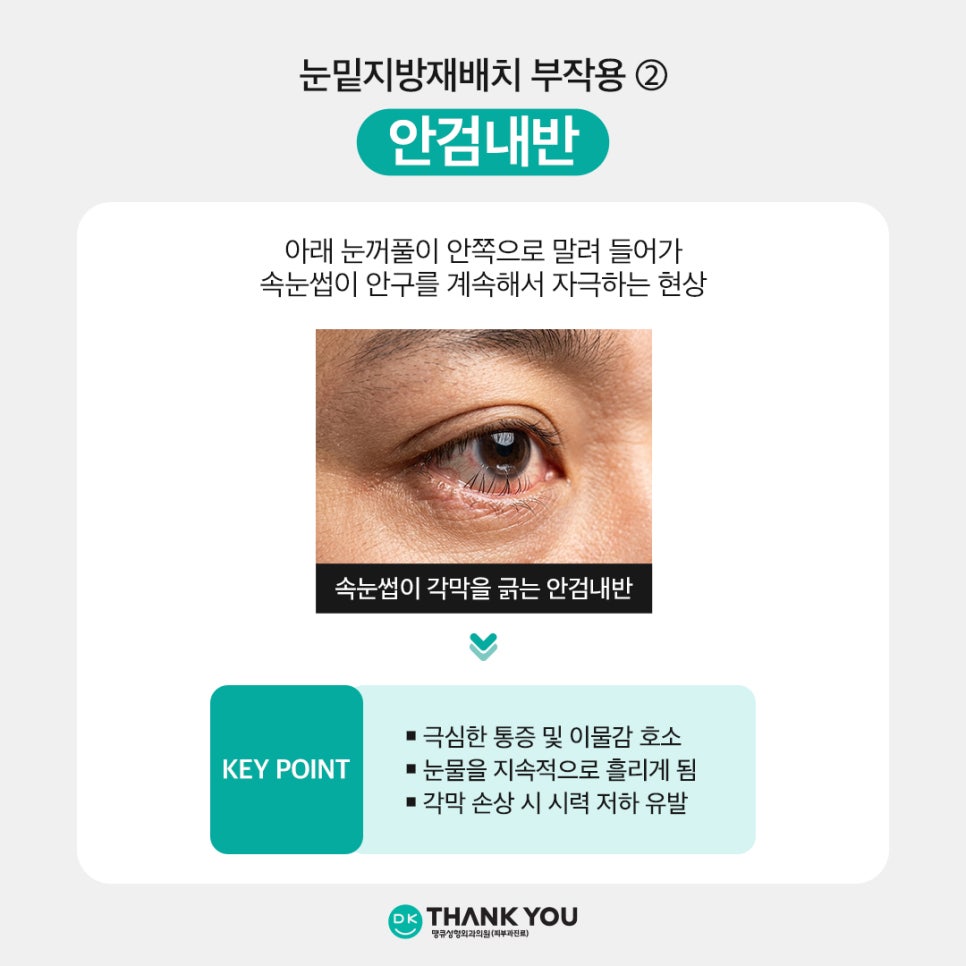 Under-Eye Fat Repositioning Side Effects: What Are the Causes and Treatment Methods?! image 4