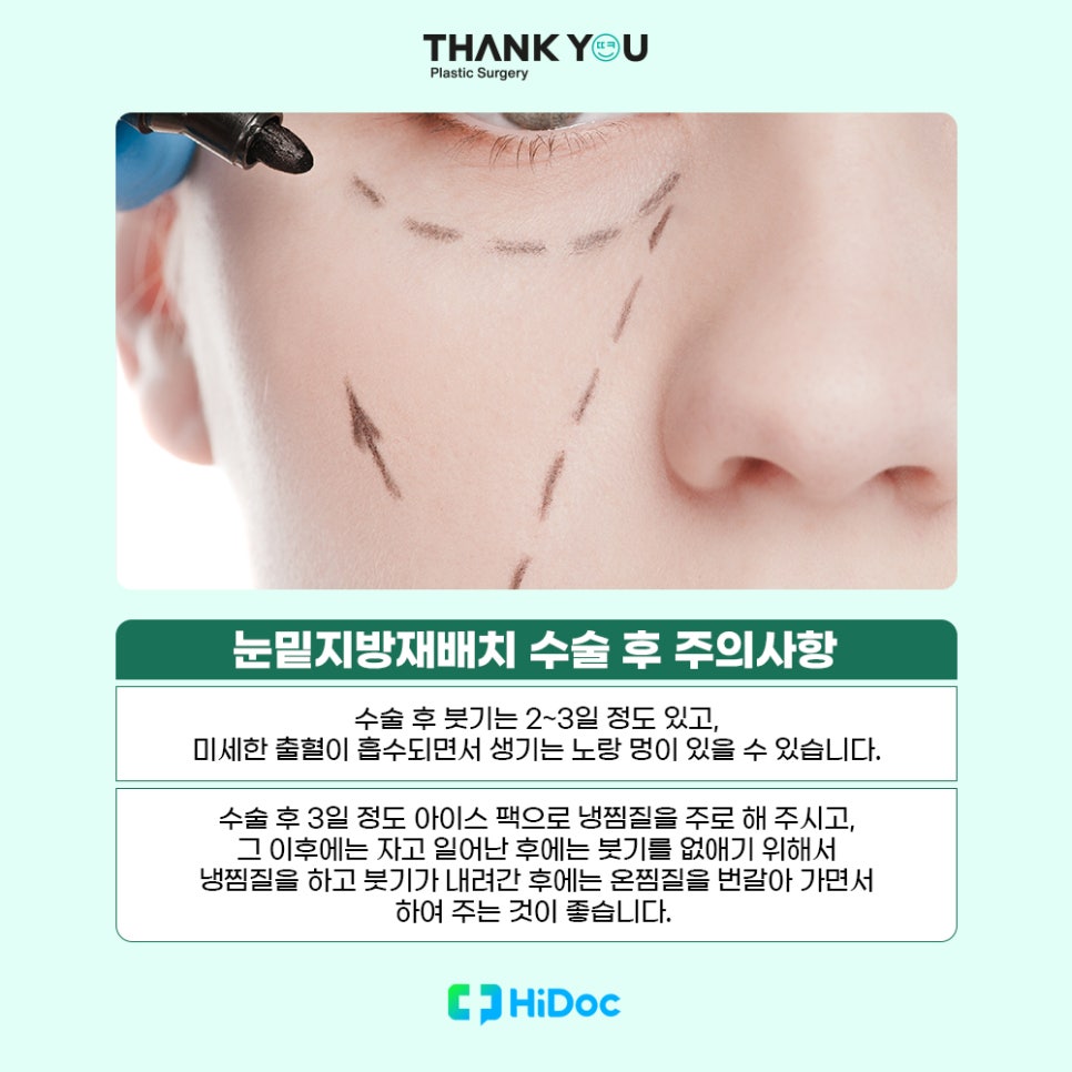 (눈밑지방불룩함)눈 지방 볼록한 이유or눈밑지 수술후 주의사항 관련 이미지 10