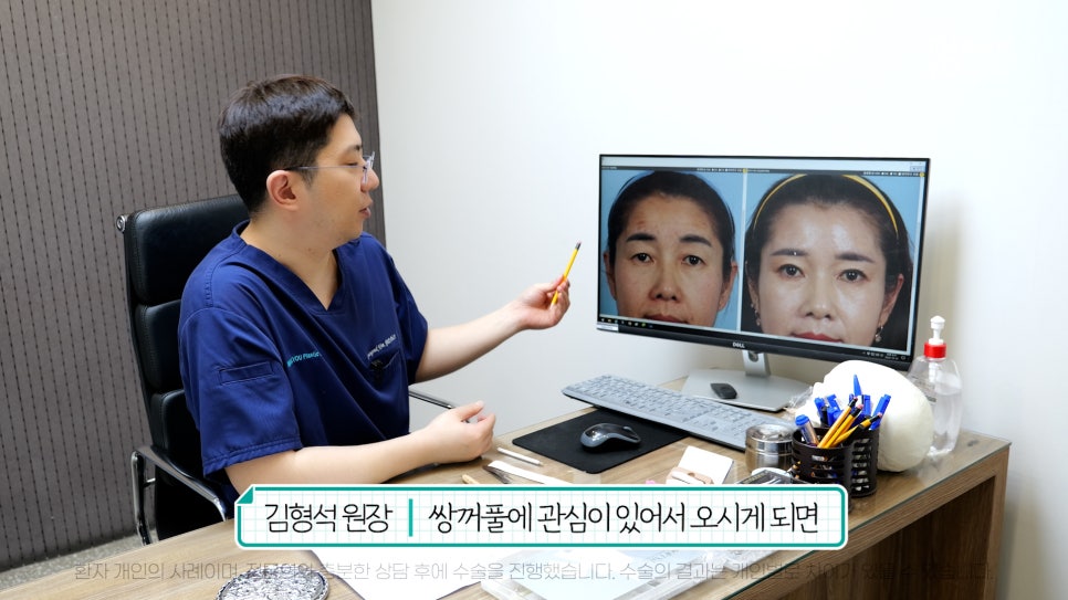 중년눈성형 전후& 이마거상+눈썹하거상+쌍수로 젊어지기 관련 이미지 6