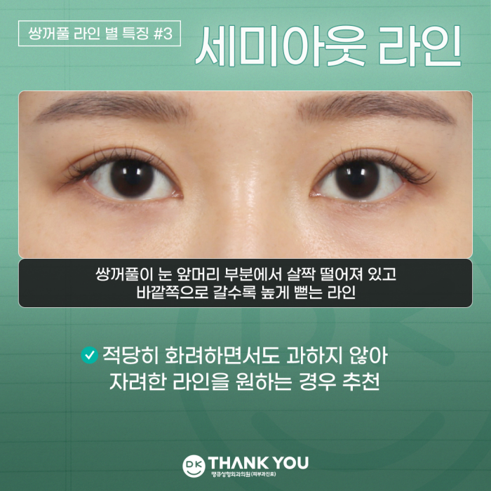 Double-Eyelid Surgery Line: Which One Suits Me Best? image 5