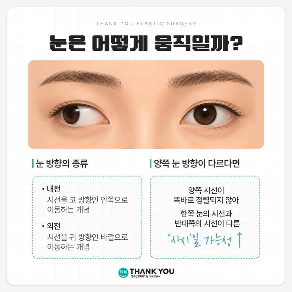 눈밑지방재배치 사시?! 눈밑지 사시는 왜 생길까 관련 이미지 2