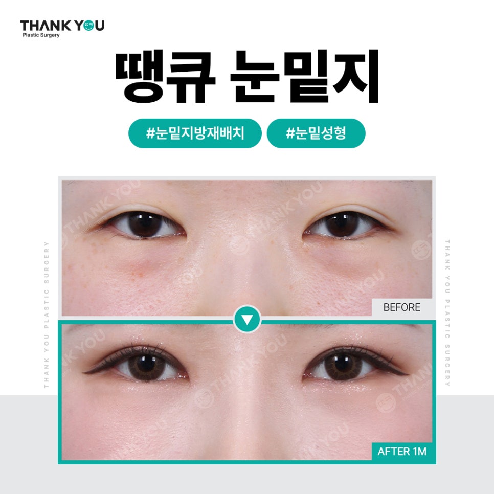 화려한 눈 가능?! 인아웃라인 김세정 쌍꺼풀처럼 관련 이미지 29