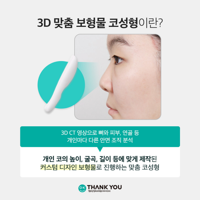 Natural-Looking Rhinoplasty with a Custom Implant That Fits Like My Original Nose! image 2