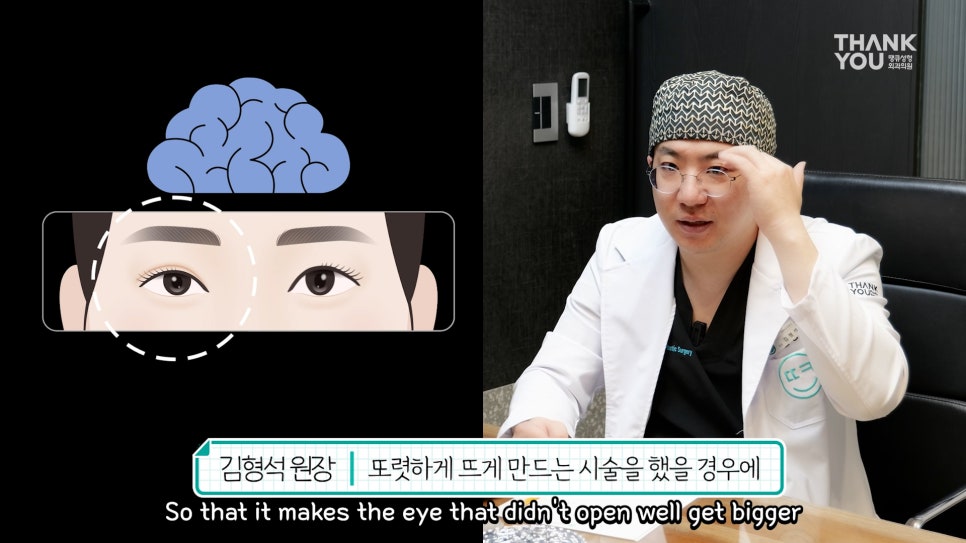 비대칭눈 교정(짝짝이 쌍꺼풀) 헤링의 법칙이란? 관련 이미지 11