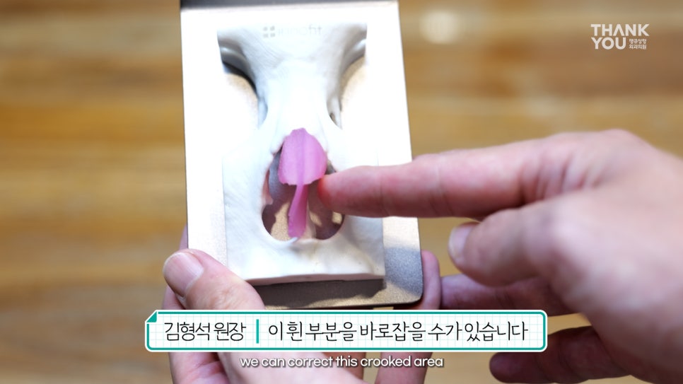 2분만에 막힌 코 뻥 뚫어주는 코블레이션 [ft.비염코성형 전후] 관련 이미지 10