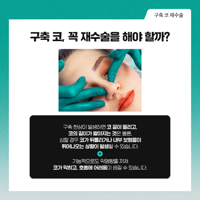 구축코재수술 개인 상태에 따른 계획이 중요해요 관련 이미지 4