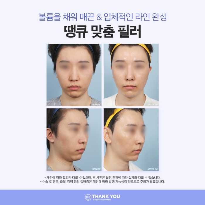 Create a Harmonious Face with Improved Face Line! Complete a Line That Suits Your Features⭐ image 6