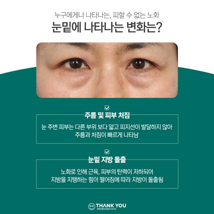 If You Want a Satisfying Difference Before and After Lower Blepharoplasty?! Thank You Dual Lower Blepharoplasty image 2