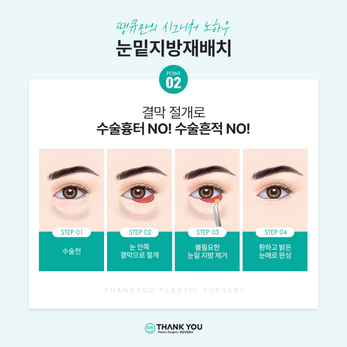 눈밑지방재배치잘하는곳은 이렇게 합니다✨✨ 관련 이미지 5