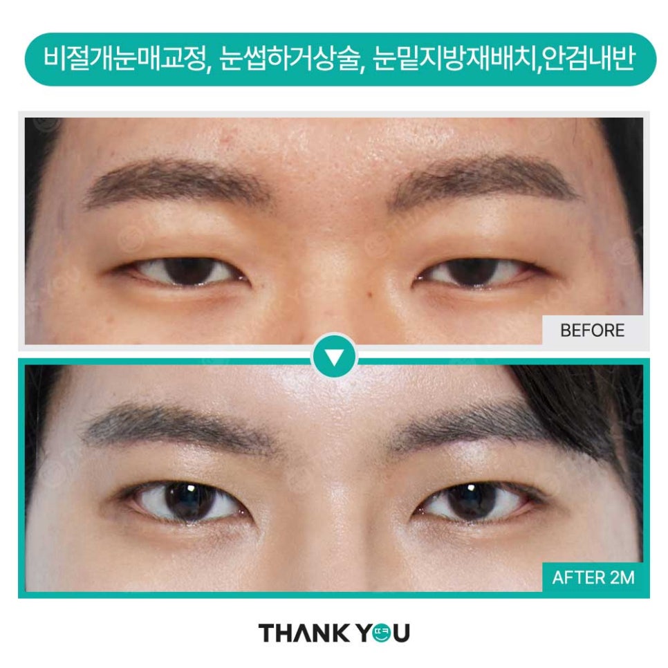 의벤져스 땡큐, 관련 이미지 8