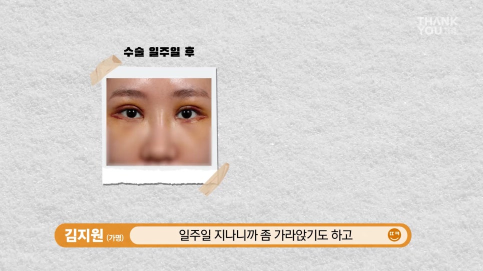 엄빠 몰래 이마거상 성공! (뒤밑트임 후기) 관련 이미지 11