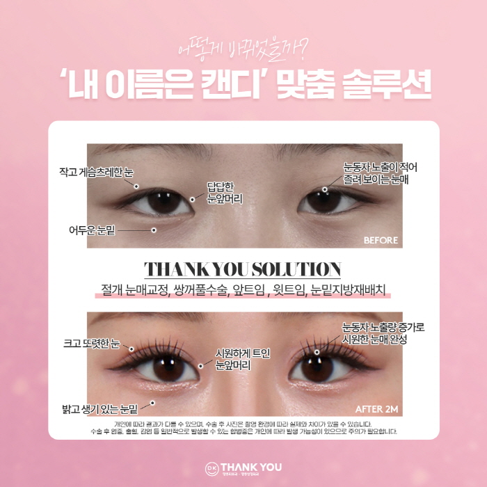 Thank You Plastic Surgery, a Hospital Skilled in Eye Surgery! Providing Customized Solutions for a Make Me Girl Case Study😉 image 4