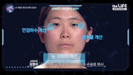 Thank You Plastic Surgery, a Hospital Skilled in Eye Surgery! Providing Customized Solutions for a Make Me Girl Case Study😉 image 3