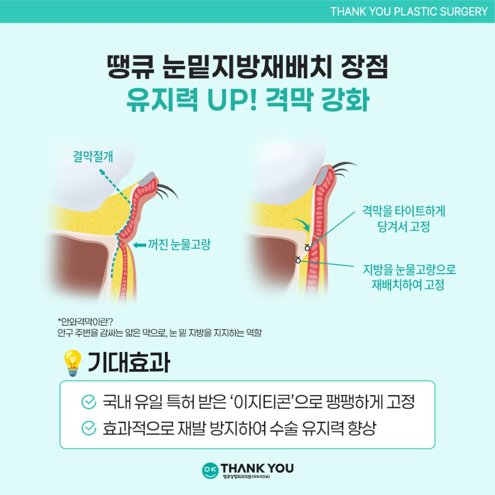 눈밑지방재배치효과? 수술 잘하는 곳 땡큐에서 확인! 관련 이미지 7
