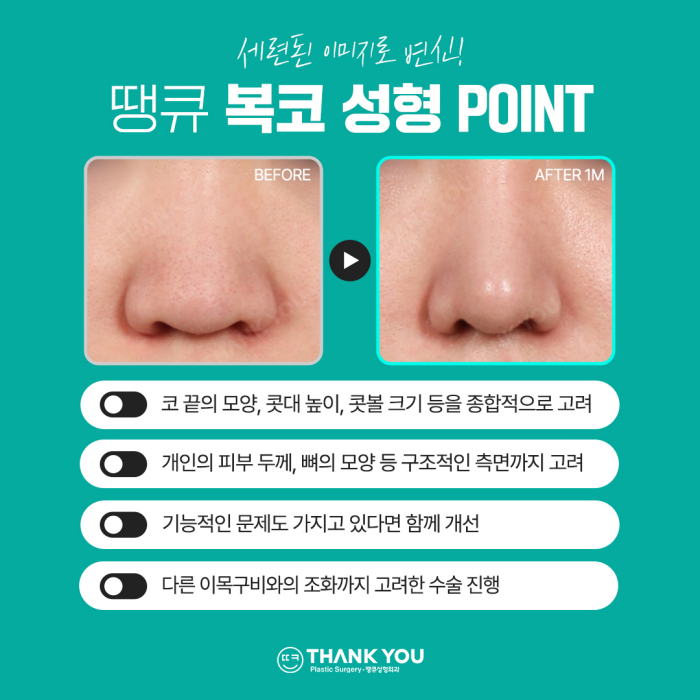 복코성형, 꼭 코뼈절골을 해야할까요? 관련 이미지 5