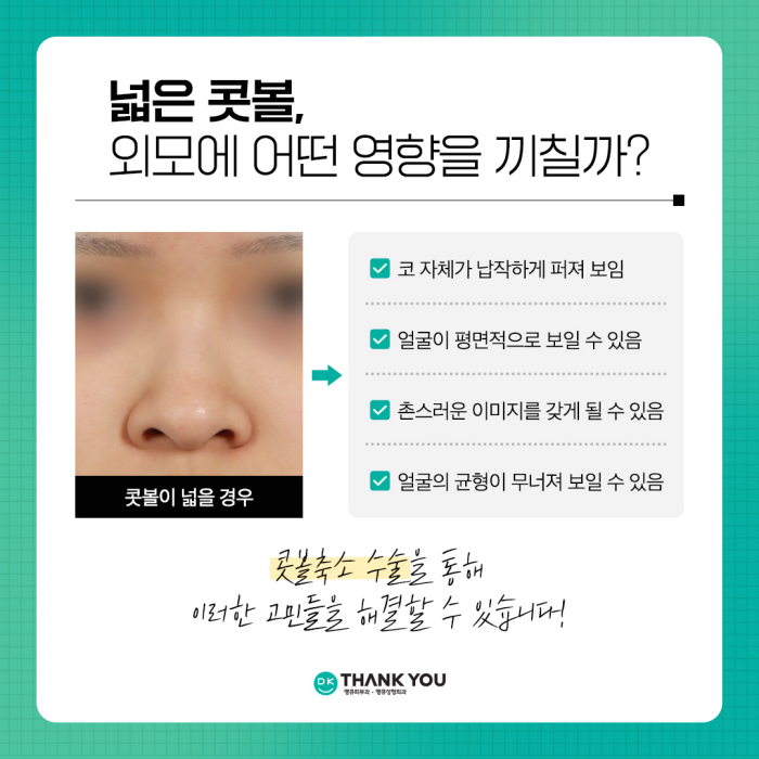 콧볼축소술로 촌스러운 이미지 만드는 콧볼줄이기! 관련 이미지 2