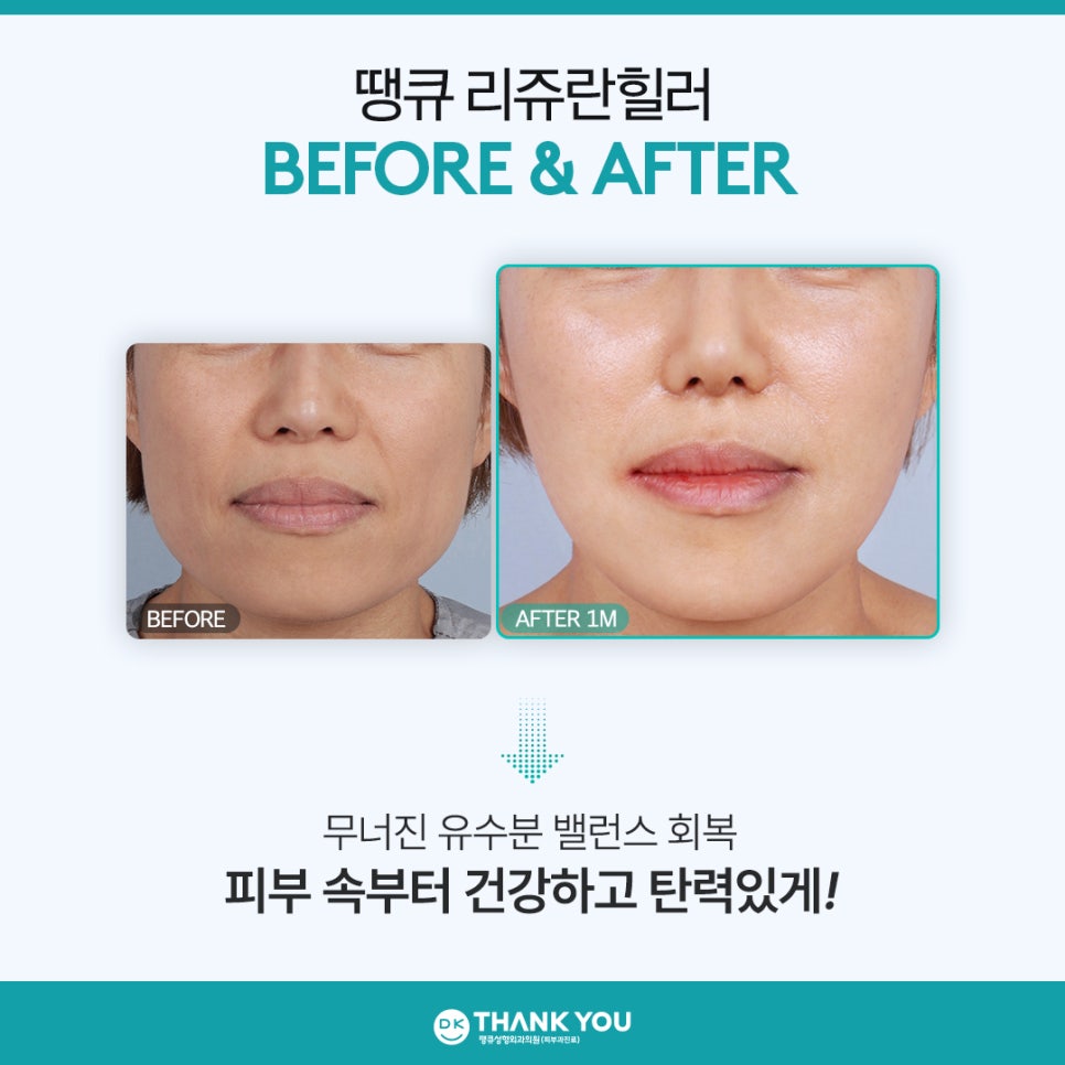 리쥬란힐러잘하는곳 땡큐에서 새해맞이 피부 고민 해결! 관련 이미지 7