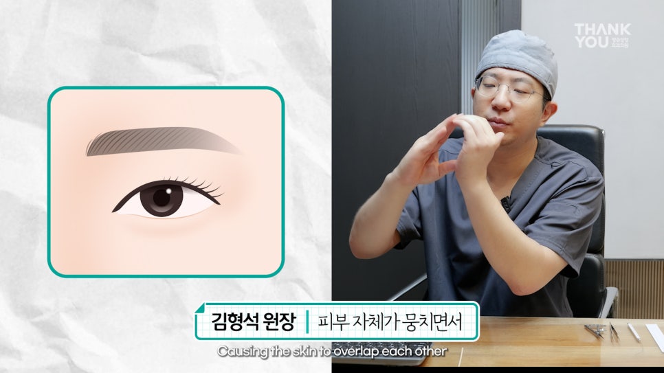 쌍수에 눈썹올림술을 추천하는 이유?! 관련 이미지 14