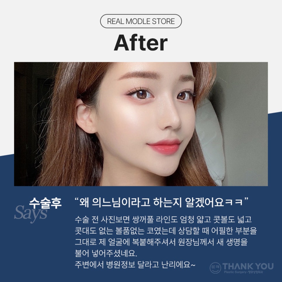 눈코성형 같이 하고싶다면? (자연유착 윗트임+콧불축소) 관련 이미지 10